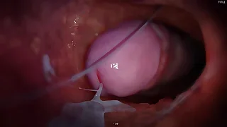 China Twink XXX Tube 36